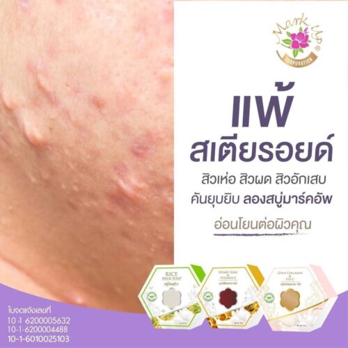 สบู่คอลลาเจลวิตซี - Image 2